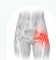 Hip pain illustration
