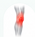 Knee pain illustration