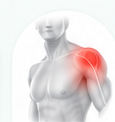 Shoulder pain illustration
