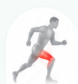 Sports injury illustration